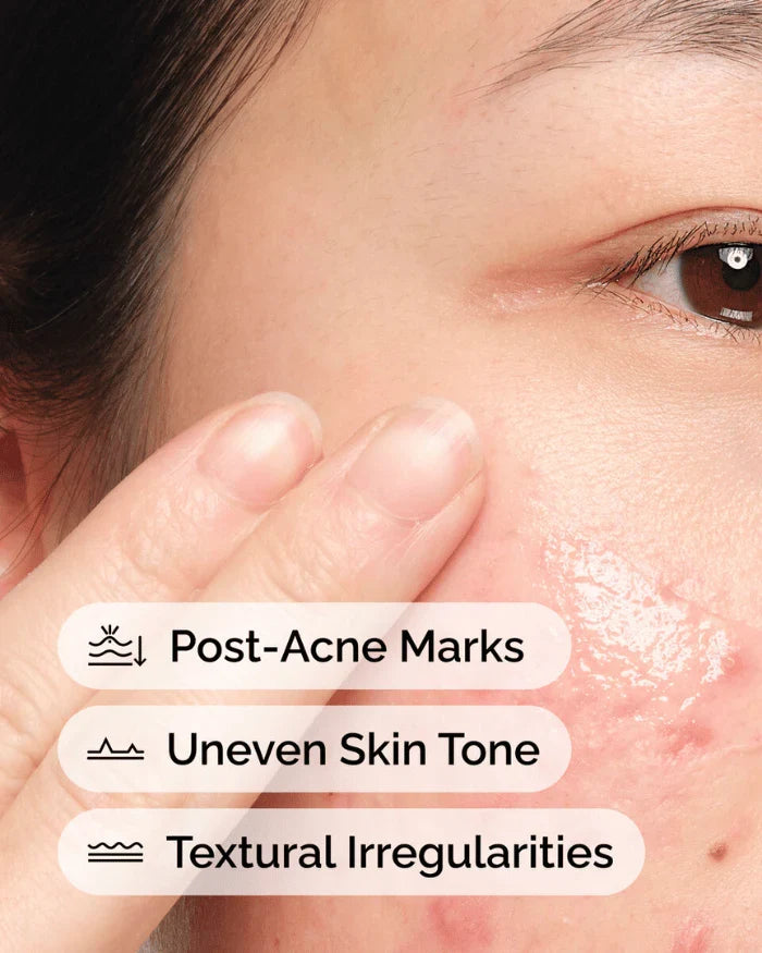 The Ordinary Niacinamide 10% + Zinc 1%